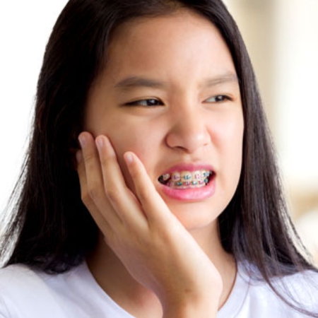 Braces