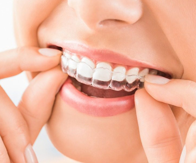 Eledent braces