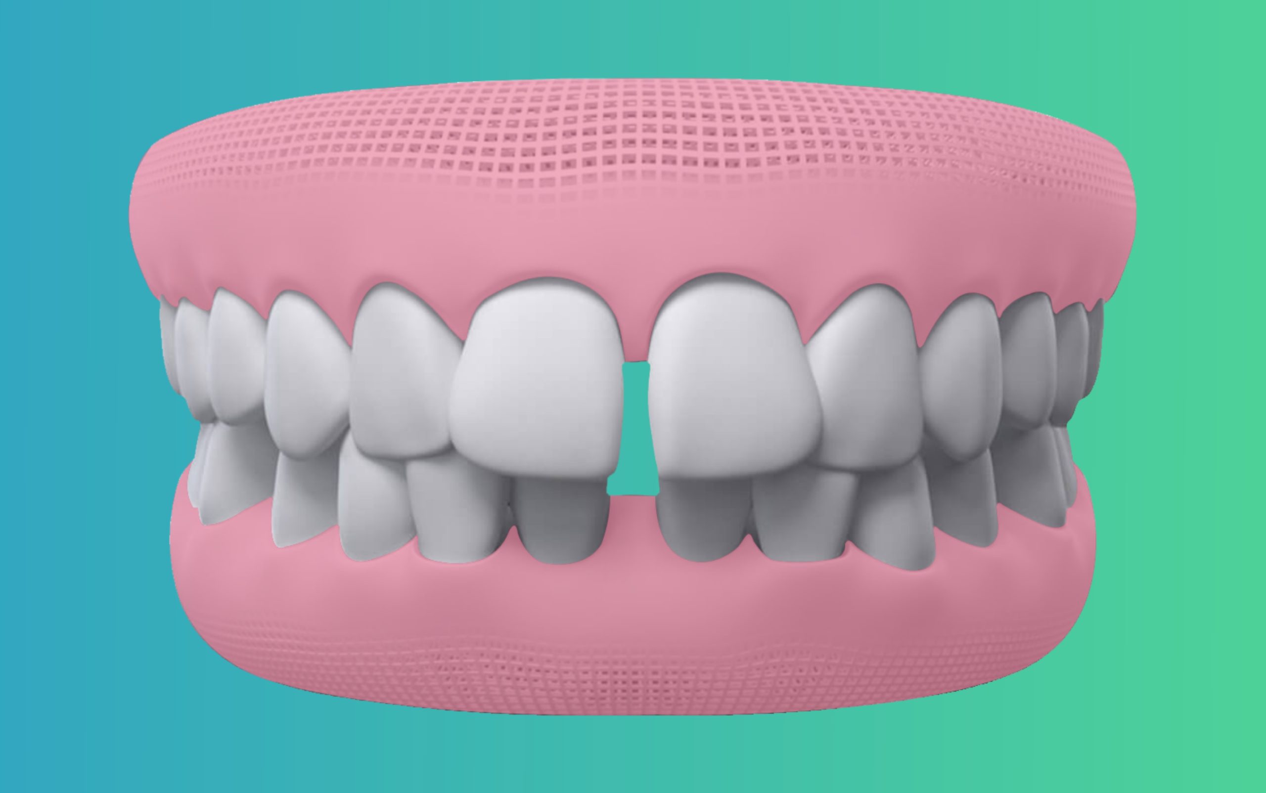 Gapped Teeth