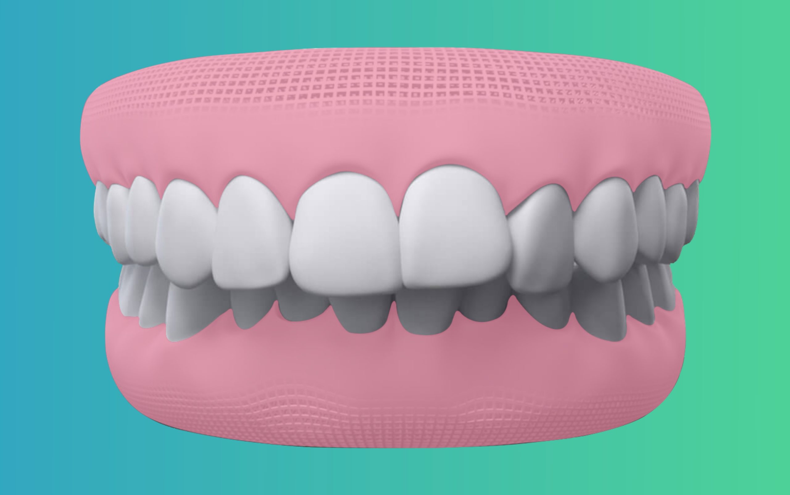 Overbite