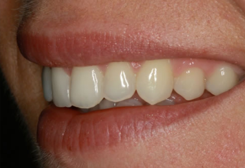 After image