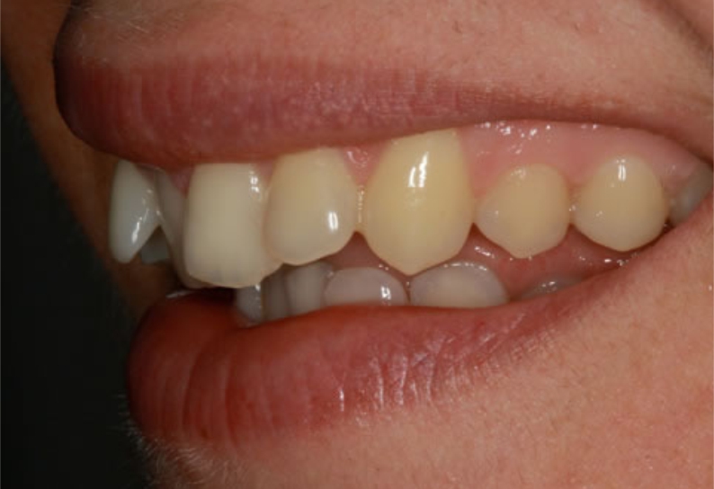Before image