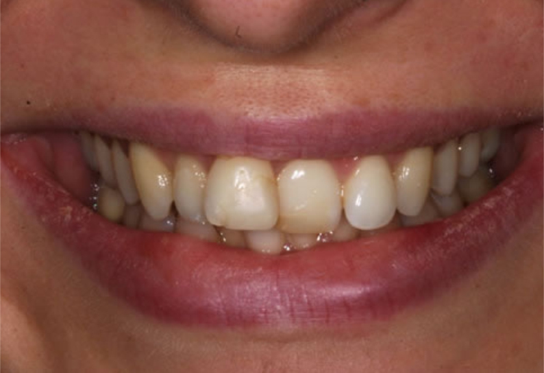 Before image