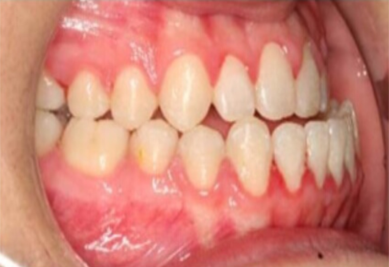 Before image
