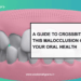 Crossbite Teeth