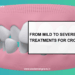 crowded teeth