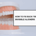 buck teeth