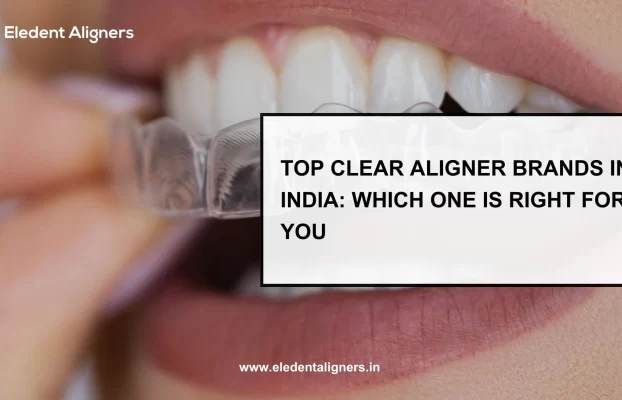 Top Clear Aligner Brands in India: Which One is Right for You